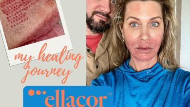 My ellacor™ healing journey (with healing progress photos and tips!)