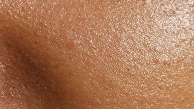 Clogged Pores and How to Avoid It