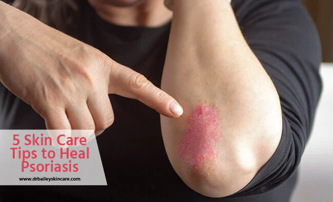 Best Skin Care to Heal Psoriasis